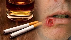 Sigara ve Alkol Kanser Riskini Artırıyor